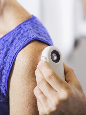 Arzt untersucht die Haut einer Patientin an der Schulter mit Dermatoskop zur Hautkrebsfrüherkennung