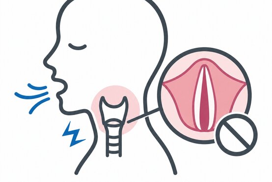 Verschluss der Stimmlippen bei der Vocal Cord Dysfunction