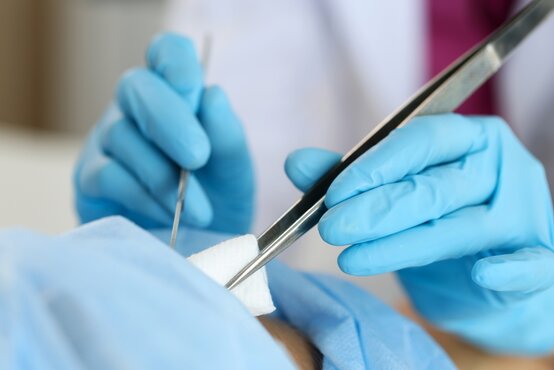 Ärztliche Hände in blauen Einmalhandschuhen halten chirurgische Pinzette mit Mullkompresse und Spatel, Wundversorgung in Klinik